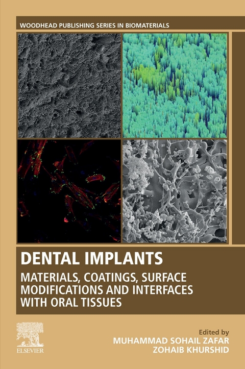 Dental Implants -  Zohaib Khurshid,  Muhammad Zafar