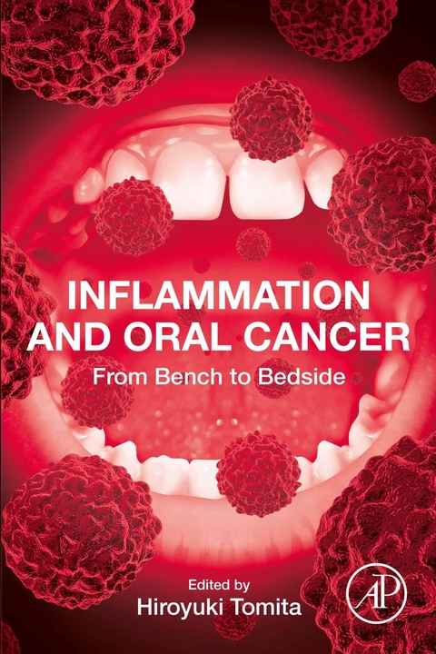 Inflammation and Oral Cancer - 