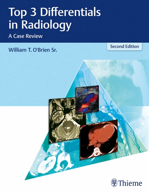 Top 3 Differentials in Radiology -  William T. O'Brien