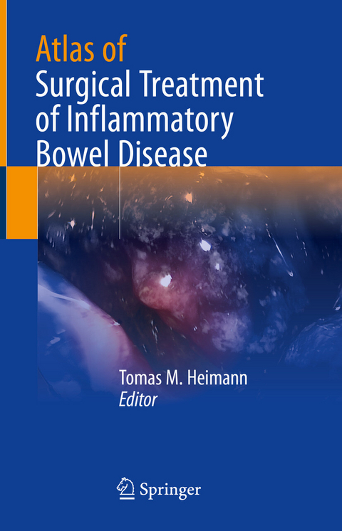 Atlas of Surgical Treatment of Inflammatory Bowel Disease - 