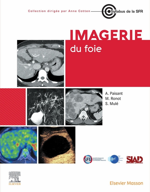 Imagerie du foie -  Sebastien Mule,  Anita Paisant,  Maxime Ronot