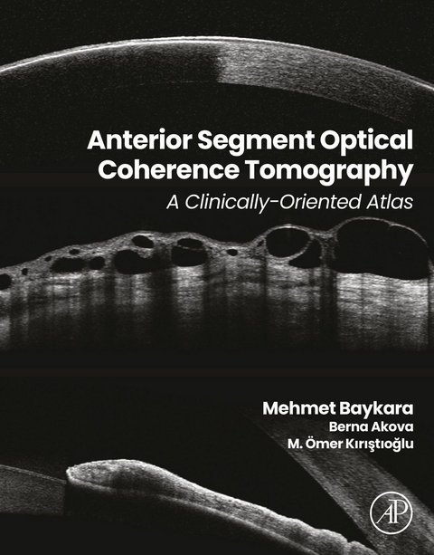 Anterior Segment Optical Coherence Tomography - 