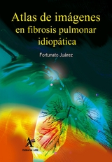 Atlas de imágenes en fibrosis pulmonar idiopática -  Fortunato Juárez Hernández