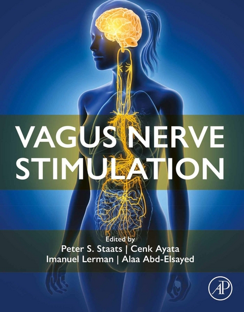 Vagus Nerve Stimulation - 