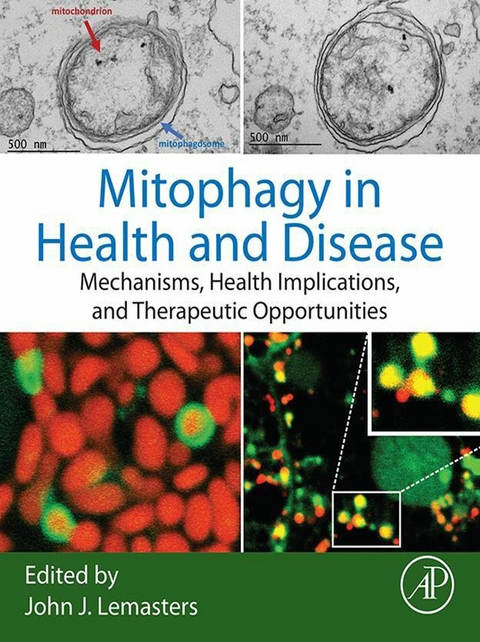 Mitophagy in Health and Disease - 