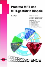 Prostata-MRT und MRT-gestützte Biopsie -  Dirk Blondin,  Lars Schimmöller,  Michael Quentin