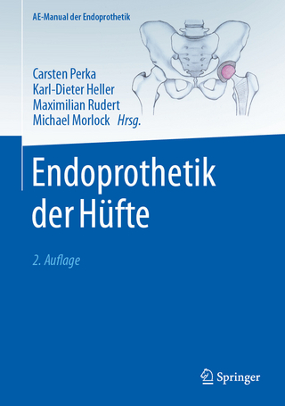 Endoprothetik der Hüfte - Carsten Perka; Karl-Dieter Heller; Maximilian Rudert …