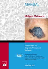 Maligne Melanome - 