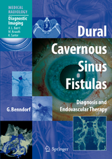 Dural Cavernous Sinus Fistulas - Goetz Benndorf
