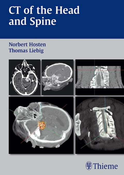 CT of the Head and Spine - Norbert Hosten, Thomas Liebig