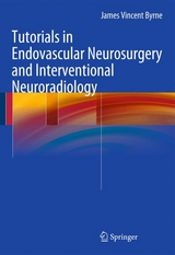 Tutorials in Endovascular Neurosurgery and Interventional Neuroradiology - James Vincent Byrne