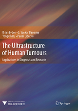 The Ultrastructure of Human Tumours - Brian Eyden, S. Sankar Banerjee, Yongxin Ru, Paweł Liberski
