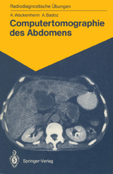 Computertomographie des Abdomens - Auguste Wackenheim, Armelle Badoz