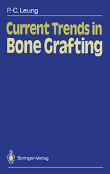 Current Trends in Bone Grafting - Ping-Chung Leung