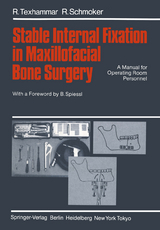 Stable Internal Fixation in Maxillofacial Bone Surgery - R. Texhammar, R. Schmoker