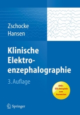 Klinische Elektroenzephalographie - 