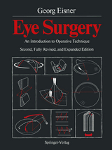 Eye Surgery - Georg Eisner