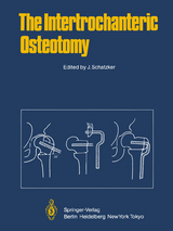 The Intertrochanteric Osteotomy - 