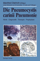 Die Pneumocystis carinii Pneumonie - 