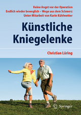 Künstliche Kniegelenke - Lüring, C.