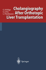 Cholangiography After Orthotopic Liver Transplantation - Gerd Nöldge, Gerd Otto, Lorenz Theilmann