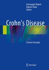 Crohn's Disease - 