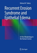 Recurrent Erosion Syndrome and Epithelial Edema - Helena M. Tabery