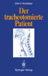 Der tracheotomierte Patient - Dirk F. Knöbber