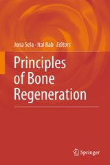 Principles of Bone Regeneration - 