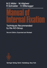 Manual of Internal Fixation - Müller, Maurice E.; Allgöwer, Martin; Schneider, Robert; Willenegger, Hans