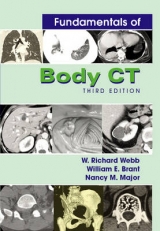 Fundamentals of Body CT - Webb, W.Richard; Brant, William E.; Major, Nancy M.