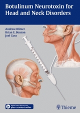 Botulinum Neurotoxin for Head and Neck Disorders - Andrew Blitzer, Brian E. Benson, Joel Guss