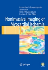 Noninvasive Imaging of Myocardial Ischemia - 