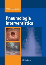 Pneumologia interventistica -  Angelo Casalini