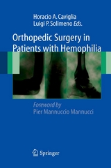 Orthopedic Surgery in Patients with Hemophilia - 