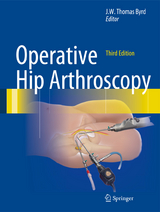 Operative Hip Arthroscopy - Byrd, J.W. Thomas
