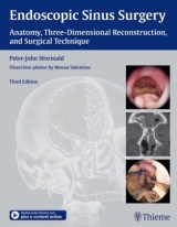 Endoscopic Sinus Surgery - Wormald, Peter-John