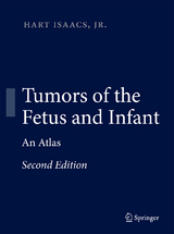 Tumors of the Fetus and Infant - Hart Isaacs