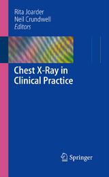 Chest X-Ray in Clinical Practice -  Neil Crundwell,  Rita Joarder