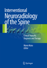 Interventional Neuroradiology of the Spine - 