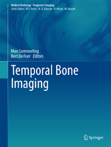 Temporal Bone Imaging - 