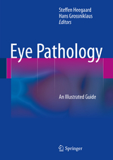 Eye Pathology - 