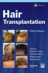 Hair Transplantation - Unger, Walter; Shapiro, Ronald; Unger, Robin; Unger, Mark