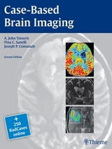 Case-Based Brain Imaging - Tsiouris, Apostolos John; Sanelli, Pina C.; Comunale, Joseph