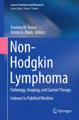 Non-Hodgkin Lymphoma - 