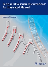 Peripheral Vascular Interventions: An Illustrated Manual - Jürgen Schröder