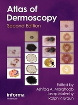 An Atlas of Dermoscopy - Marghoob, Ashfaq; Braun, Ralph