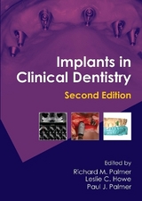 Implants in Clinical Dentistry - Palmer, Richard M.; Howe, Leslie C.; Palmer, Paul J.