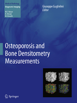 Osteoporosis and Bone Densitometry Measurements - 