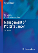 Management of Prostate Cancer - 